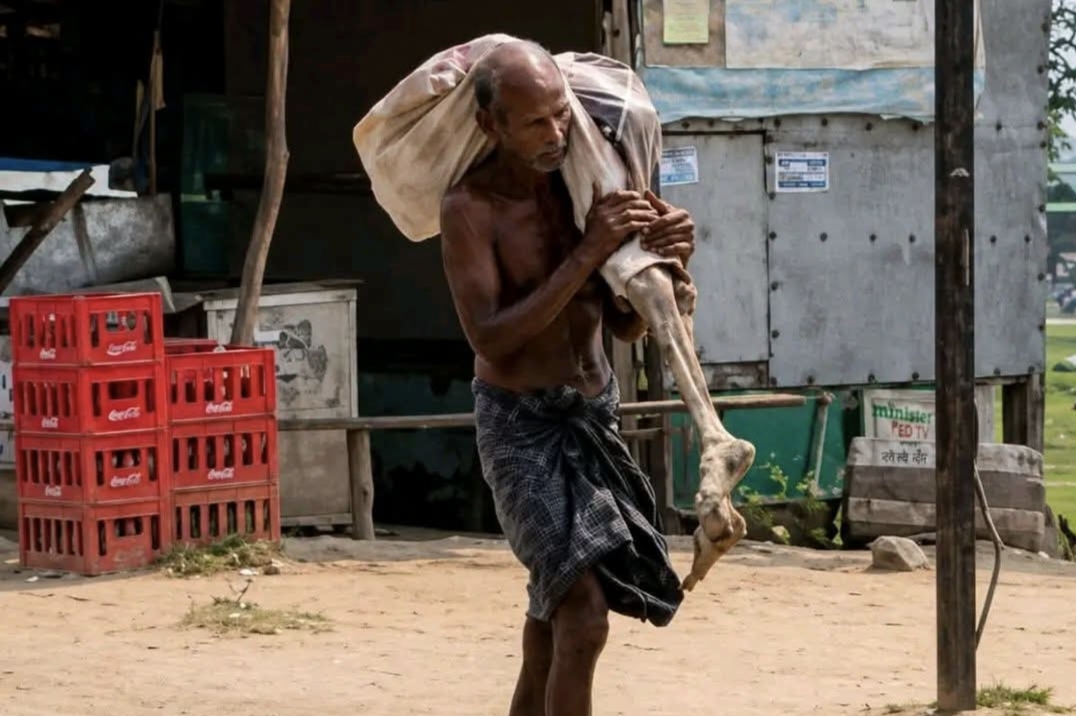 মৃত বোনের টাকা উদ্ধারে কঙ্কাল নিয়ে ব্যাংকে হাজির ভাই!